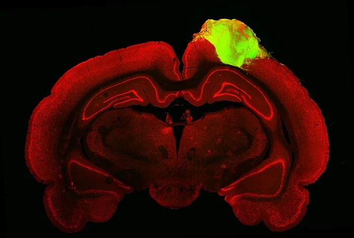 تصویر ارگانوئید مغز انسان به موش پیوند زده شد